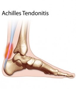 Injured tendons like loading!
